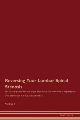 Cover of Reversing Your Lumbar Spinal Stenosis