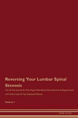 Book cover for Reversing Your Lumbar Spinal Stenosis