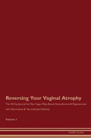 Cover of Reversing Your Vaginal Atrophy