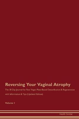 Book cover for Reversing Your Vaginal Atrophy