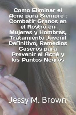 Cover of Como Eliminar el Acne para Siempre