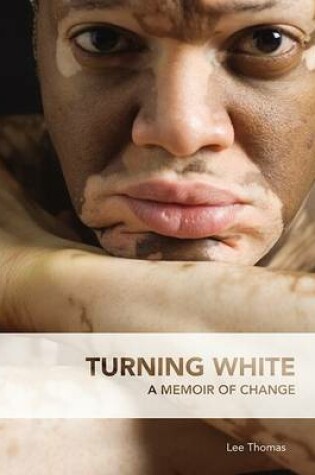 Cover of Turning White