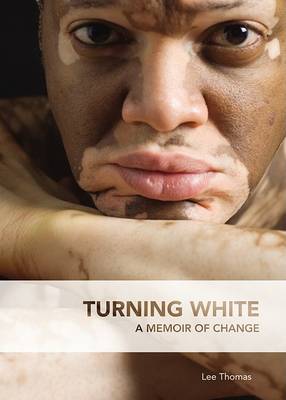 Book cover for Turning White