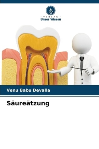 Cover of Säureätzung