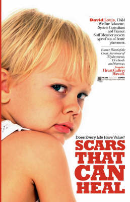 Book cover for Scars That Can Heal