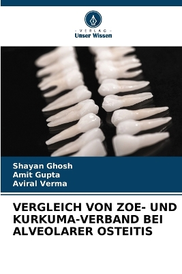 Book cover for Vergleich Von Zoe- Und Kurkuma-Verband Bei Alveolarer Osteitis