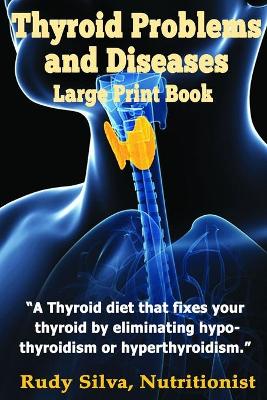 Book cover for Thyroid Problems and diseases