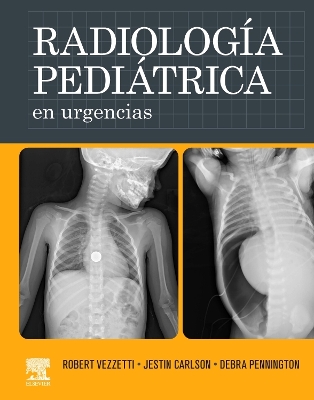 Cover of Radiología Pediátrica En Urgencias