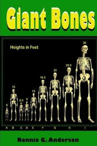 Cover of Giant Bones