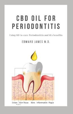 Book cover for CBD Oil for Periodontitis