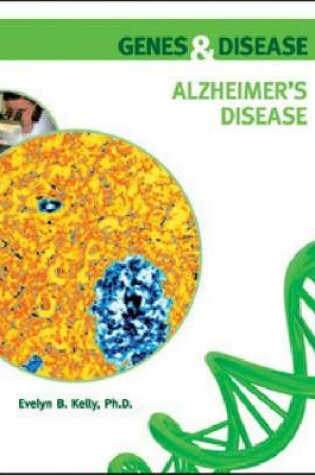 Cover of Alzheimer's Disease