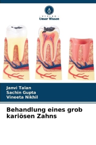 Cover of Behandlung eines grob kari�sen Zahns