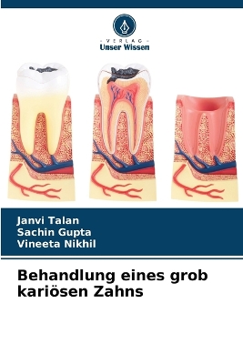 Book cover for Behandlung eines grob kari�sen Zahns