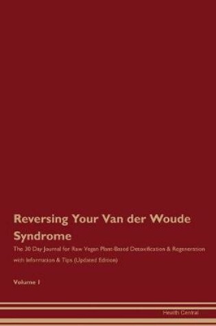 Cover of Reversing Your Van der Woude Syndrome