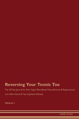 Cover of Reversing Your Tennis Toe