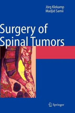 Cover of Surgery of Spinal Tumors