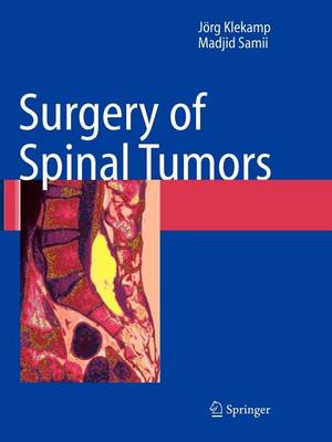 Cover of Surgery of Spinal Tumors