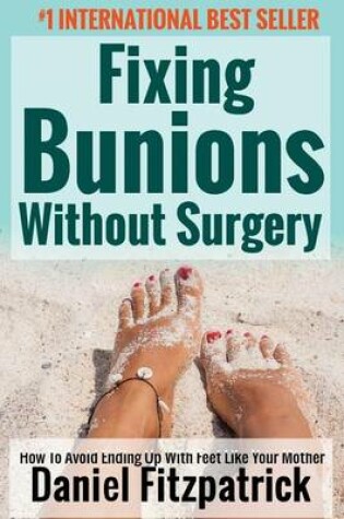 Cover of Fixing Bunions Without Surgery