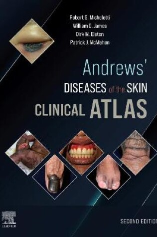 Cover of Andrews' Diseases of the Skin Clinical Atlas, E-Book