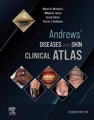 Cover of Andrews' Diseases of the Skin Clinical Atlas, E-Book