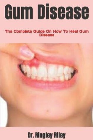 Cover of Gum Disease