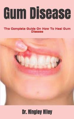 Book cover for Gum Disease