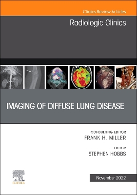 Cover of Imaging of Diffuse Lung Disease, an Issue of Radiologic Clinics of North America, E-Book