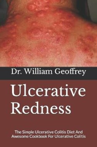 Cover of Ulcerative Redness