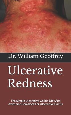 Book cover for Ulcerative Redness