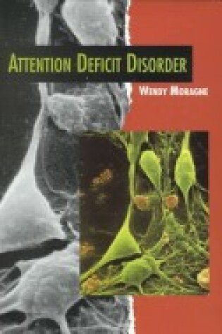 Cover of Attention Deficit Disorder