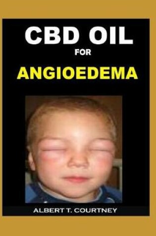 Cover of CBD Oil for Angioedema