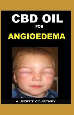 Book cover for CBD Oil for Angioedema