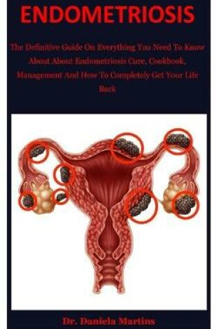 Cover of Endometriosis