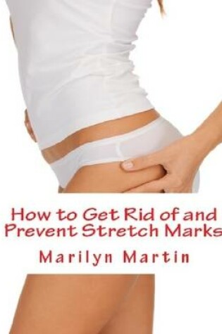 Cover of How to Get Rid of and Prevent Stretch Marks