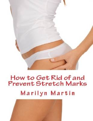 Book cover for How to Get Rid of and Prevent Stretch Marks