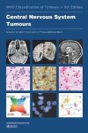 Book cover for Central Nervous System Tumours