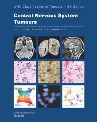 Book cover for Central Nervous System Tumours