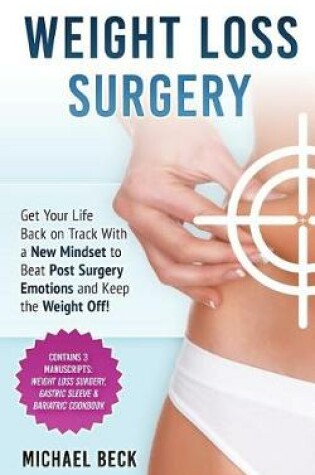 Cover of Weight Loss Surgery