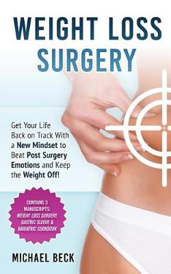 Book cover for Weight Loss Surgery