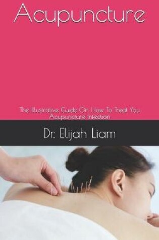 Cover of Acupuncture