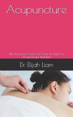 Book cover for Acupuncture