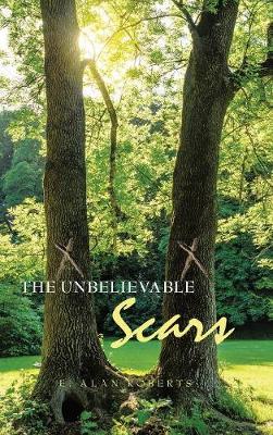 Book cover for The Unbelievable Scars