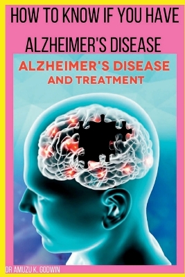 Cover of How to know if you have Alzheimers disease