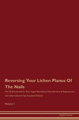 Cover of Reversing Your Lichen Planus Of The Nails