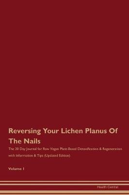 Book cover for Reversing Your Lichen Planus Of The Nails