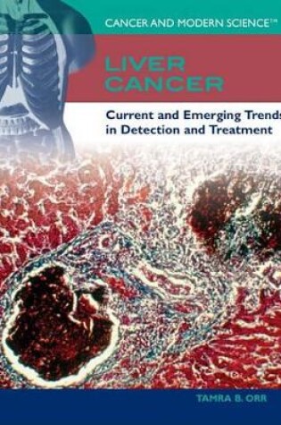 Cover of Liver Cancer