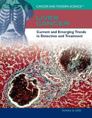Book cover for Liver Cancer