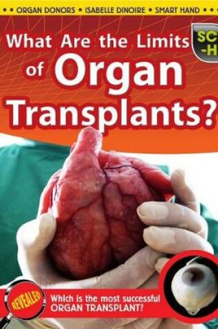 Cover of What Are the Limits of Organ Transplants?