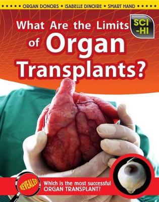 Cover of What Are the Limits of Organ Transplants?