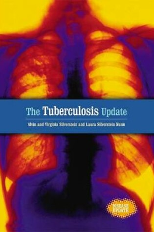 Cover of The Tuberculosis Update